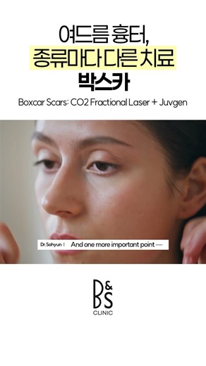 Acne Scar Boxcar 🗃️ | Different Treatments for Each Type | #shorts