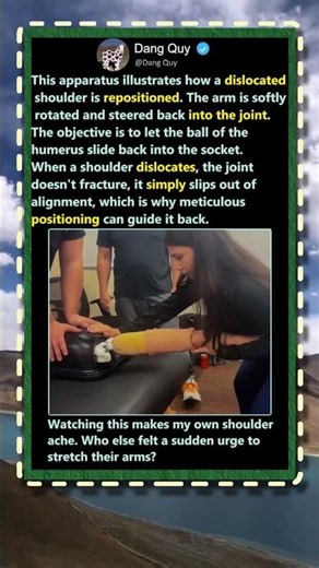 How A Dislocated Shoulder Actually Gets Fixed! #Science #Health #Education