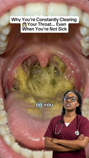 Understanding Excess Mucus in Your Throat Symptoms