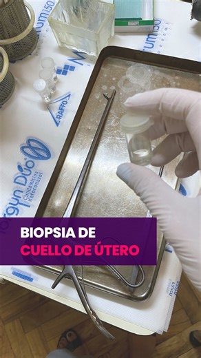 Lorena Pacienza | Ginecología integral on Instagram: "Acá te explico qué es una biopsia de cuello de útero y cuándo se indica hacerla. Si tenés dudas, ¡escribime! 💜 #biopsia #utero #controlgonecológico"