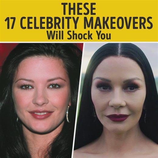 Bright Side on Reels