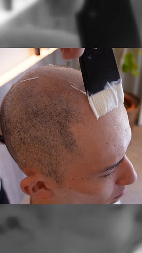 Head massage to improve blood circulation in the scalp #massage #asmr