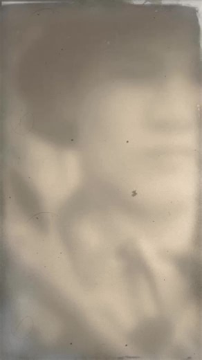 nghĩa chân sẹo trên TikTok