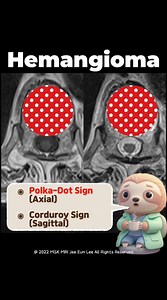 6.9K views · 16 reactions | #MRI #anatomy #lesions #knee | CT Scan and MRI study | Facebook