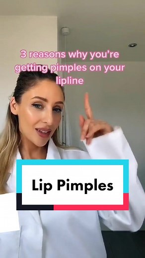 Effective Ways to Treat Lip Pimples and Blackheads