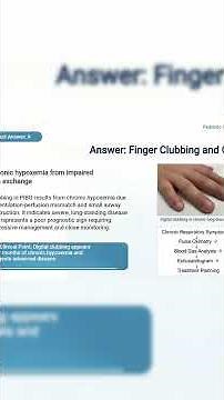 Bronchiolitis Obliterans: Spot the Advanced Disease Signs | Pediatric Case Review