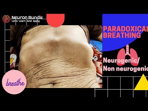 Paradoxical breathing pattern / Diaphragmatic paradox #paradoxicalrespiration #diaphragmaticpalsy