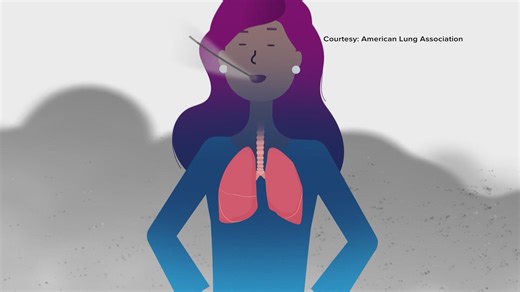 American Lung Association releases State of the Air report