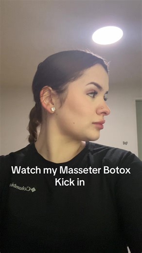 I love it and I didn’t faint this time #tox #botox #masseterbotox