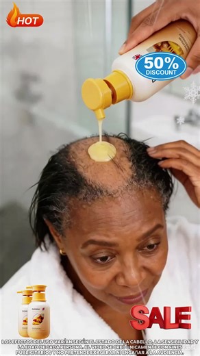 Champú efectivo para suprimir la pérdida de cabello