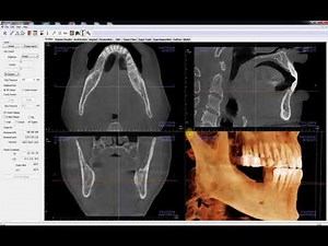 Invivo™ 5.4.5 Training Series: Introduction to the Section View Tab