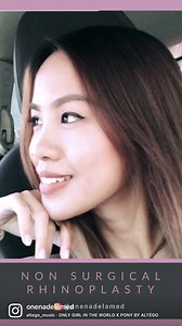 Non surgical nose thread lifting, also known as 15-minute nose job, is a safe and non-invasive procedure with minimal downtime. Results are immediate and will last anywhere from 2-3 years for a natural look.‌ #nonsurgicalrhinoplasty #nosethreadlift #rhinoplastybeforeandafter #rhinoplastycebu #onenadelamed #onenadelafam | One Nadela Medical Group