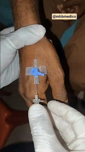 Perfect IV Cannula Insertion Technique 💉 | Step-by-Step Guide #shorts