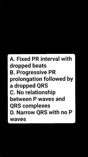 Which ECG finding is characteristic of second-degree AV block type I (Wenckebach)?