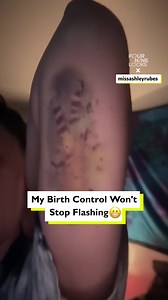 My birth control implant is flashing inside me 😳 | Four Nine Looks