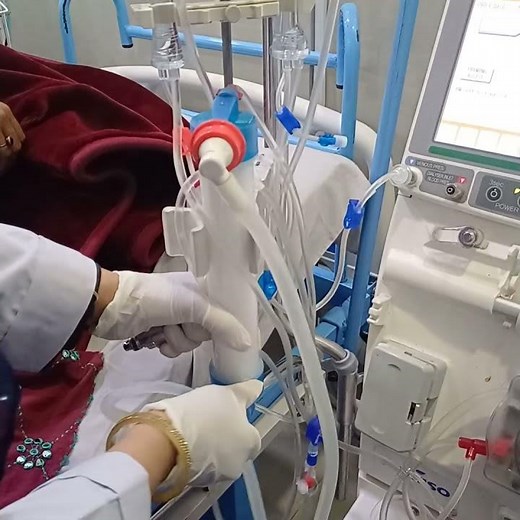 Nikkiso dialysis machine dialystate lines