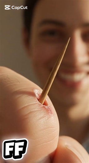 What Happens If a Splinter Gets Stuck Forever