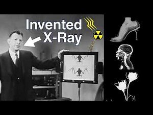 The History of X-ray in Medical Imaging