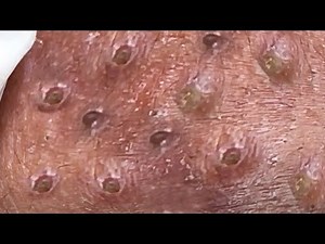 Satisfying Relaxing Best Video with Win Spa #132