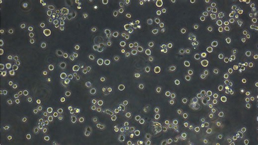 A-549 Cells人非小细胞肺癌细胞|包含STR图谱