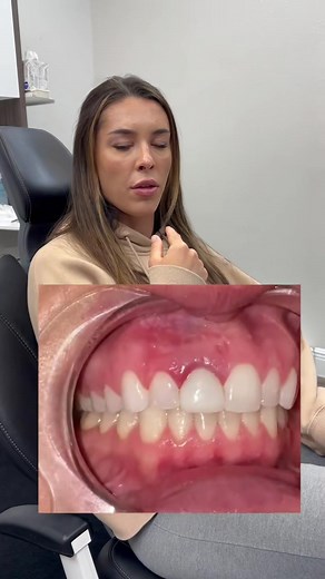 This Easter, we're on a heartwarming mission to spread joy and happiness as we bring new smiles to the most deserving faces 🥰🐰 Sit back, grab some chocolate eggs, and watch this touching video that will remind us all about the true spirit of the holiday! 👉💖 #EasterSmiles #SweetSurprises #HolidayJoy | Smile Again Dental - Texas