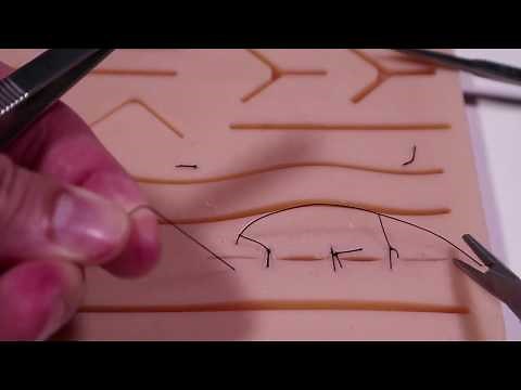 Simple Interrupted Suture Technique
