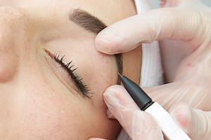 Electrolysis Hair Removal Wimbledon & Kensington, London