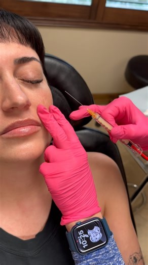 1K views · 37 reactions | Why we use PRF injection part 3: PRF gel is...