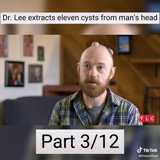 #CapCut #drlee #drsandralee #pimplepopper #drpimplepopper #cyst #cystsurgery #cysts #foryourpage #fyp #foryou