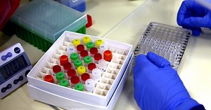 What can coronavirus antibody tests actually tell us?