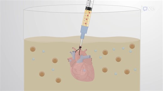 视频: Langendorff 逆行心脏灌注:一种灌注离体小鼠心脏的离体技术 - 实验
