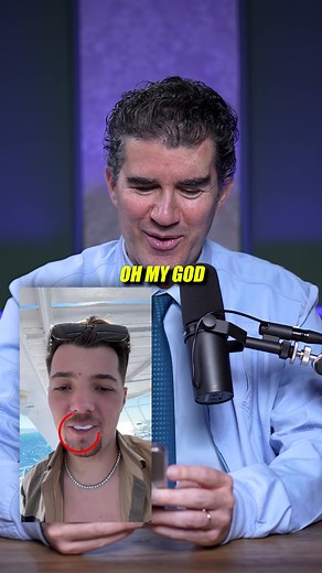 The Truth About Dental Veneers Explained