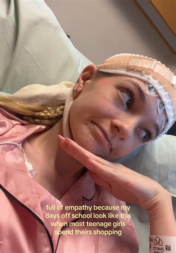 Understanding Epilepsy and Daily Challenges