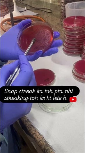 Wire loop streaking on culture plate