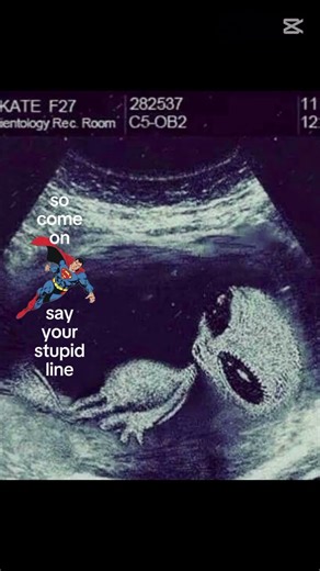 TYSM FOR 200 SUBS #funny #superman #shorts #edit #alien