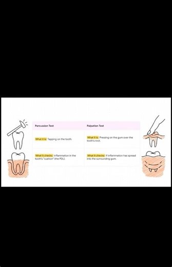 PALPATION AND PERCUSSION TEST #Dentistry #DentalCare #DentalEducation #OralHealth #DentalLife #inbde