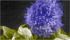 Revving up the immune system to fight cancer