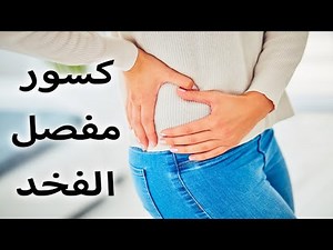كسور مفصل الفخذ