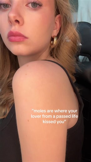 Understanding Past Life Moles and Their Meanings