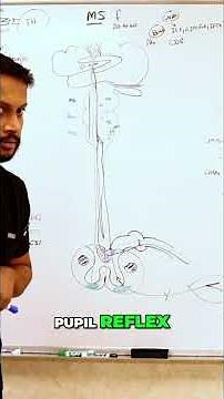 MS & RAPD: Understanding Pupillary Reflex in Minutes! #shorts