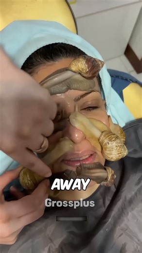Snail therapy #shorts #science