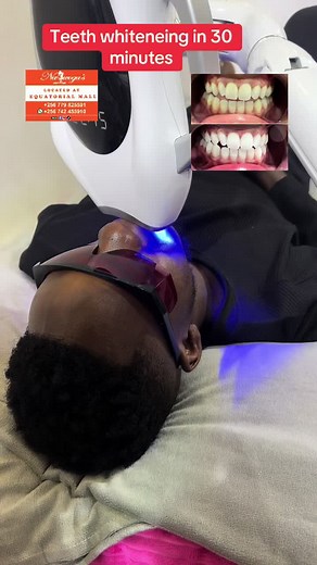 #EidMubarak #viral #foryoupage❤️❤️ #kampala_uganda🇺🇬🇺🇬🤝 #trendingvideo #viral_video #video #alienskinug