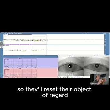 If Your Eyes Aren't Doing This Your Brain Might Be Struggling