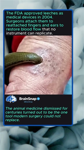 How Leeches Save Severed Limbs
