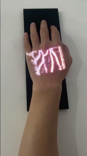 Who Can Tell Me What Lighting Shows Veins the Best? Discover the Power of Projection Vein Finders!