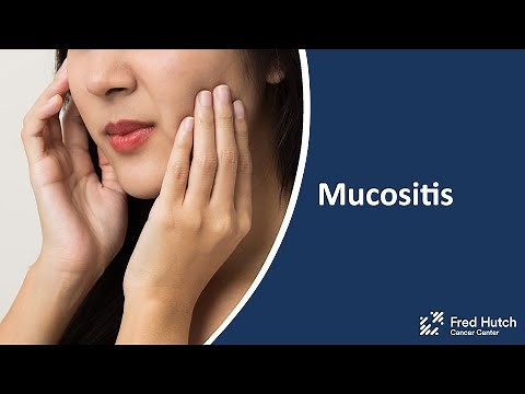 Mucositis: During and After Cancer Treatment