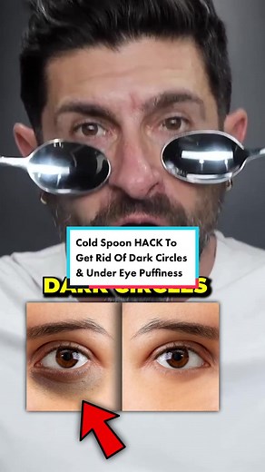 The Cold Spoon HACK To Get Rid Of Dark Circles & Under Eye Puffiness