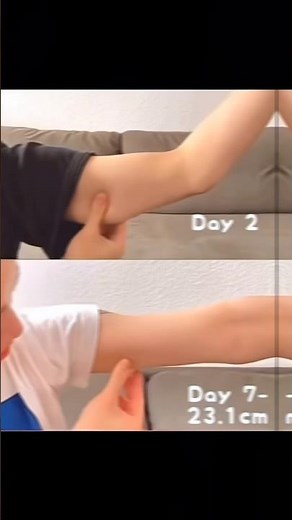 5-Minute Slim Arms Workout at Home | No Equipment