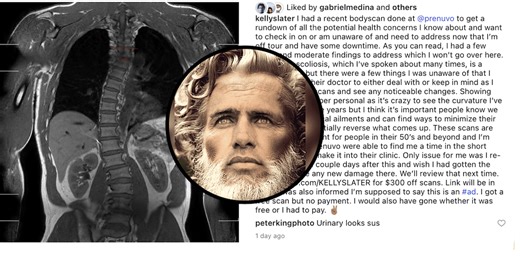 Kelly Slater Shares Shocking Health Update With Fans