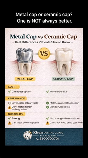 Metal Cap vs Ceramic Cap | Which Dental Crown Is Better for You? #dentist #ytshorts #youtubeshorts